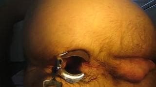 Découvrir l'ouverture de sa rondelle !